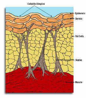 cellulite cellulite