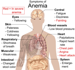 Symptoms_of_anemia
