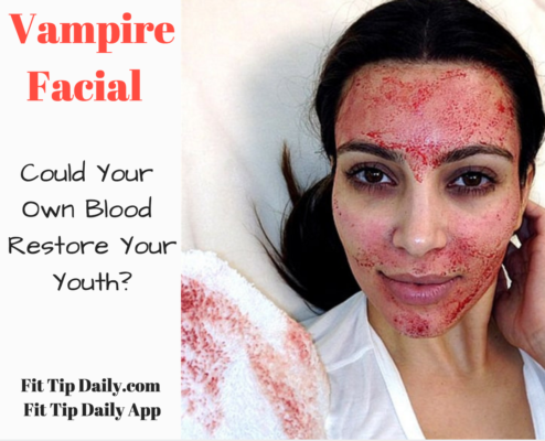 Vampire Facial – Fountain of Youth or Hype